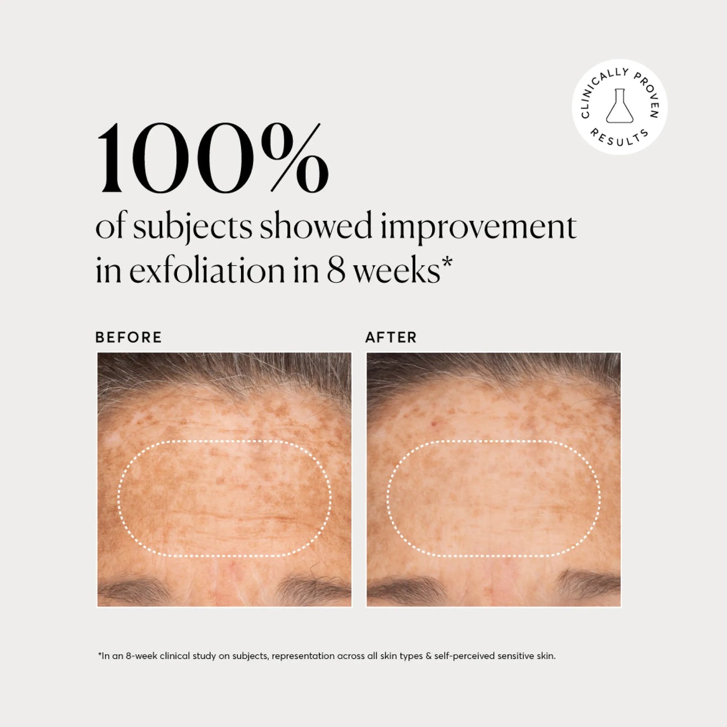 bha-liquid-exfoliant-2-i7 NATR-10027-Alt-Images-BHA-Liquid-Exfoliant-2_-03.webp